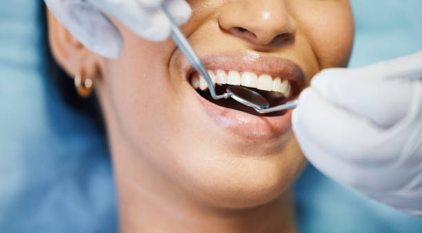 Best Emergency Gum Treatment in Lake Nacimiento, CA